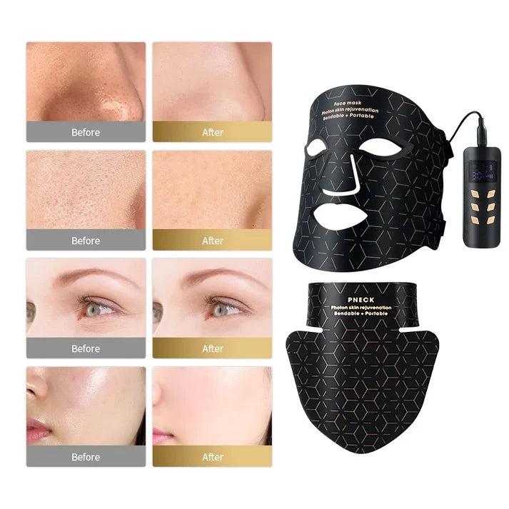 Silicone LED Face & Neck Mask | Anti-Aging Photon Light Therapy for Skin Rejuvenation & Brightening